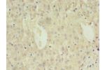 Immunohistochemistry of paraffin-embedded human liver tissue using CSB-PA006494LA01HU at dilution 1:100