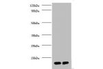 Western blot<br />
All lanes:D-amino acid oxidase activator antibody at 2ug/ml<br />
Lane 1: PC-3 whole cell lysate<br />
Lane 2: mouse gonad tissue<br />
Secondary<br />
Goat polyclonal to Rabbit IgG at 1/10000 dilution<br />
Predicted band size: 19,2,10