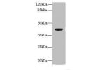 Western blot<br />
All lanes: DAPK2 antibody at 6ug/ml+ Mouse brain tissue<br />
Goat polyclonal to rabbit at 1/10000 dilution<br />
Predicted band size: 43,56 kDa<br />
Observed band size: 43 kDa<br />