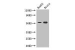 Western Blot<br />
Positive WB detected in:HepG2 whole cell lysate,Mouse brain tissue<br />
All lanes: DAPK3 antibody at 3.4ug/ml<br />
Secondary<br />
Goat polyclonal to rabbit IgG at 1/50000 dilution<br />
Predicted band size: 53,38 kDa<br />
Observed b