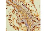 Immunohistochemistry of paraffin-embedded human testis tissue using CSB-PA006502LA01HU at dilution of 1:100