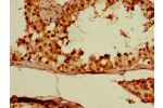 Immunohistochemistry of paraffin-embedded human testis tissue using CSB-PA006514LA01HU at dilution of 1:100