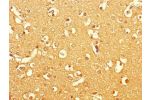 Immunohistochemistry of paraffin-embedded human brain tissue using CSB-PA006515LA01HU at dilution of 1:100