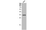 Western Blot analysis of K562 cells using Cdx2 Polyclonal Antibody