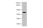 Western blot<br />
All lanes: DCN antibody at 6ug/ml+Jurkat whole cell lysate<br />
Goat polyclonal to rabbit at 1/10000 dilution<br />
Predicted band size: 40 kDa<br />
Observed band size: 40 kDa<br />