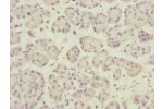 Immunohistochemistry of paraffin-embedded human pancreatic tissue using CSB-PA006566ESR1HU at dilution of 1:100