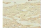Immunohistochemistry of paraffin-embedded human skeletal muscle tissue using CSB-PA006566ESR2HU at dilution of 1:100