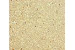 Immunohistochemistry of paraffin-embedded human brain tissue using CSB-PA006566LA01HU at dilution 1:100