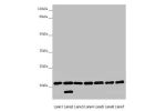 Western blot<br />
All lanes:DCTN6 antibody at 3.03 ug/ml<br />
Lane 1 : Mouse lung tissue<br />
Lane 2 : Mouse gonadal tissue<br />
Lane 3 : A549 whole cell lysate<br />
Lane 4 : U251 whole cell lysate<br />
Lane 5 : Mouse thymus tissue<br />
Lane 6 : Ra