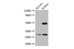 Western Blot<br />
Positive WB detected in:Mouse lung tissue,Mouse kidney tissue<br />
All lanes: DDAH2 antibody at 2.5ug/ml<br />
Secondary<br />
Goat polyclonal to rabbit IgG at 1/50000 dilution<br />
Predicted band size: 30 kDa<br />
Observed band size