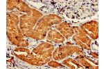 Immunohistochemistry of paraffin-embedded human kidney tissue using CSB-PA006583LA01HU at dilution of 1:100