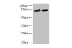 Western blot<br />
All lanes: DDHD2 antibody at 10ug/ml<br />
Lane 1 : K562 whole cell lysate<br />
Lane 2 : U251 whole cell lysate<br />
Secondary<br />
Goat polyclonal to Rabbit IgG at 1/10000 dilution<br />
Predicted band size: 82,38 kDa<br />
Observed