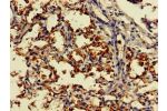 Immunohistochemistry of paraffin-embedded human lung tissue using CSB-PA006593LA01HU at dilution of 1:100
