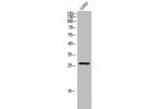 Western Blot analysis of LOVO cells using C/EBP d/e Polyclonal Antibody