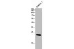 Western Blot analysis of RAW264.7 cells using C/EBP ? Polyclonal Antibody