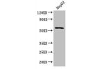 Western Blot<br />
Positive WB detected in:HepG2 whole cell lysate<br />
All lanes: DDX6 antibody at 2.8ug/ml<br />
Secondary<br />
Goat polyclonal to rabbit IgG at 1/50000 dilution<br />
Predicted band size: 55 kDa<br />
Observed band size: 55 kDa<br />