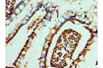 Immunohistochemistry of paraffin-embedded human small intestine using CSB-PA006652ESR1HU at dilution 1:100