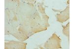 Immunohistochemistry of paraffin-embedded human skeletal muscle tissue using CSB-PA006655ESR2HU at dilution 1:100