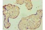 Immunohistochemistry of paraffin-embedded human placenta tissue using CSB-PA00667A0Rb at dilution 1:100