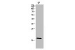 Western Blot analysis of KB cells using Choriogonadotropin 