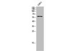 Western Blot analysis of 22RV1 cells using Chk2 Polyclonal Antibody