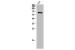 Western Blot analysis of COS7 cells using Chk2 Polyclonal Antibody