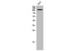 Western Blot analysis of 293T cells using Ataxin-2L Polyclonal Antibody