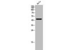 Western Blot analysis of HeLa cells using mAChR M2 Polyclonal Antibody