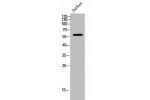 Western Blot analysis of Jurkat cells using mAChR M5 Polyclonal Antibody