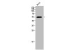 Western Blot analysis of Hela cells using AChR