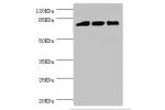 Western blot<br />
All lanes:DGKA antibody at 6.48ug/ml<br />
Lane 1:Hela whole cell lysate<br />
Lane 2:Jurkat whole cell lysate<br />
Lane 3:293T whole cell lysate<br />
Secondary<br />
Goat polyclonal to rabbit at 1/10000 dilution<br />
Predicted band 