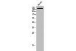 Western Blot analysis of HuvEc cells using A Cyclase IX Polyclonal Antibody