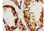Immunohistochemistry of paraffin-embedded human testis tissue using CSB-PA006854LA01HU at dilution of 1:100