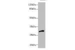 Western blot<br />
All lanes: DHRS12 antibody at 1.3ug/ml+ Human placenta tissue<br />
Goat polyclonal to rabbit at 1/10000 dilution<br />
Predicted band size: 36,28,31 kDa<br />
Observed band size: 31 kDa<br />