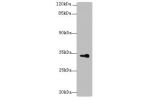 Western blot<br />
All lanes: DHRS3 antibody at 6ug/ml+Mouse kidney tissue<br />
Goat polyclonal to rabbit at 1/10000 dilution<br />
Predicted band size: 34,19 kDa<br />
Observed band size: 34 kDa<br />