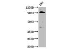 Western Blot<br />
Positive WB detected in:293 whole cell lysate<br />
All lanes:DHX15 antibody at 3.7