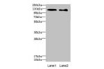 Western blot<br />
All lanes: DIAPH2 antibody at 4.75ug/ml<br />
Lane 1 : 293T whole cell lysate<br />
Lane 2 : Hela whole cell lysate<br />
Secondary<br />
Goat polyclonal to rabbit IgG at 1/10000 dilution<br />
Predicted band size: 126,125 kDa<br />
Obs