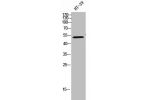 Western Blot analysis of HT-29 cells using CYP2R1 Polyclonal Antibody