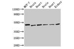 Western Blot<br />
Positive WB detected in:MCF-7 whole cell lysate,Rat brain tissue,Rat heart tisue,Mouse brain tissue,Mouse heart tissue,Mouse kidney tissue<br />
All lanes:DKC1 antibody at 2.5