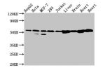 Western Blot<br />
Positive WB detected in:HepG2 whole cell lysate,Hela whole cell lysate,MCF-7 whole cell lysate,293 whole cell lysate,Jurkat whole cell lysate,Rat liver tissue,Rat brain tissue,Rat heart tissue,Mouse heart tissue<br />
All lanes:DLD anti