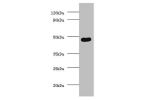 Western blot<br />
All lanes: protein delta homolog 1 antibody at 2ug/ml+U251 whole cell lysate<br />
Secondary<br />
Goat polyclonal to Rabbit IgG at 1/10000 dilution<br />
Predicted band size: 42,34 kDa<br />
Observed band size: 41 kDa<br />