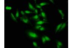 Immunofluorescence staining of Hela cells with CSB-PA006952LA01HU at 1:66,counter-stained with DAPI. The cells were fixed in 4% formaldehyde, permeabilized using 0.2% Triton X-100 and blocked in 10% normal Goat Serum. The cells were then incubated with th