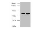 Western blot<br />
All lanes: DMKN antibody at 6ug/ml<br />
Lane 1 : Mouse kidney tissue<br />
Lane 2 : Mouse liver tissue<br />
Secondary<br />
Goat polyclonal to Rabbit IgG at 1/10000 dilution<br />
Predicted band size: 48,16,37,46,39,42,36,21,19,17,15,