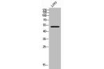 Western Blot analysis of LOVO cells using FoxN4 Polyclonal Antibody