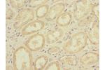 Immunohistochemistry of paraffin-embedded human kidney tissue CSB-PA006982LA01HU at dilution 1:100
