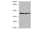 Western blot<br />
All lanes:DNAJA2 antibody at 3.79ug/ml<br />
Lane 1:A375 whole cell lysate<br />
Lane 2:PC-3 whole cell lysate<br />
Lane 3:HepG2 whole cell lysate<br />
Lane 4:Hela whole cell lysate<br />
Secondary<br />
Goat polyclonal to rabbit at 1