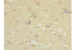 Immunohistochemistry of paraffin-embedded human brain tissue CSB-PA007008DSR1HU at dilution 1:100