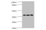 Western blot<br />
All lanes:DNAJB5 antibody at 2ug/ml<br />
Lane 1:HepG2 whole cell lysate<br />
Lane 2:Hela whole cell lysate<br />
Lane 3:Jurkat whole cell lysate<br />
Secondary<br />
Goat polyclonal to rabbit at 1/10000 dilution<br />
Predicted band 