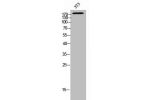 Western Blot analysis of 3T3 cells using MRP2 Polyclonal Antibody
