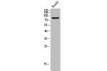 Western Blot analysis of HepG2 cells using CNG-1 Polyclonal Antibody
